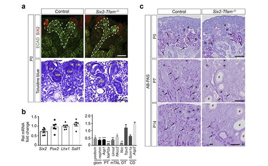 cistanches is good for polycystic kidney disease